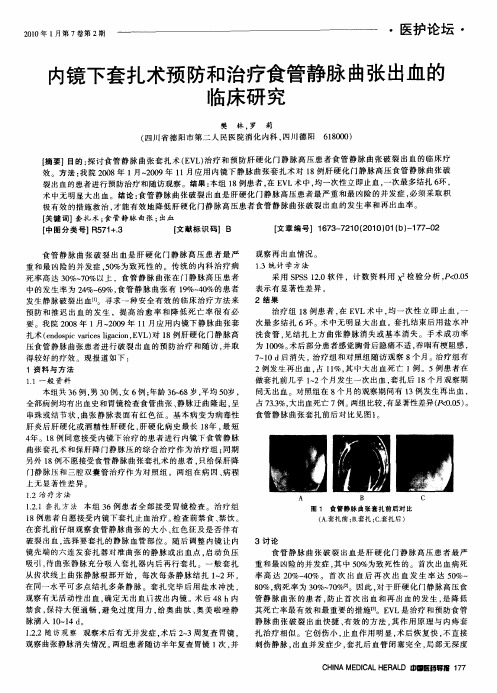内镜下套扎术预防和治疗食管静脉曲张出血的临床研究
