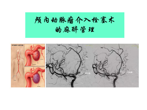 颅内动脉瘤介入栓塞术的麻醉管理课件