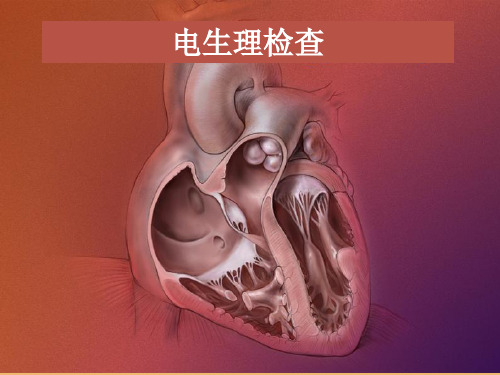 电生理检查