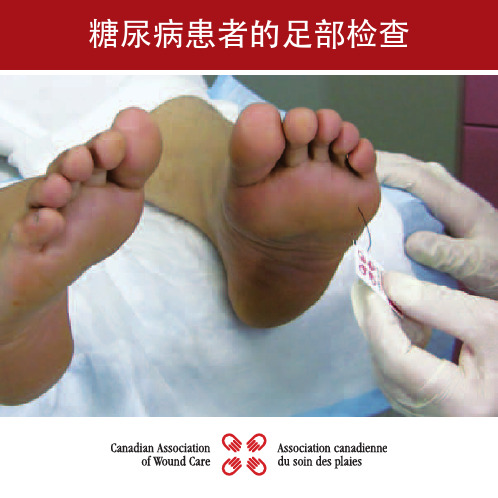 糖尿病患者的足部检查-Home-WoundsCanada