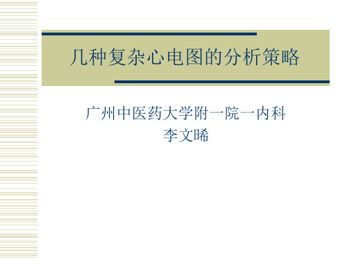 几种复杂心电图的分析策略