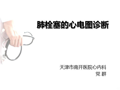 肺栓塞的心电图诊断PPT课件