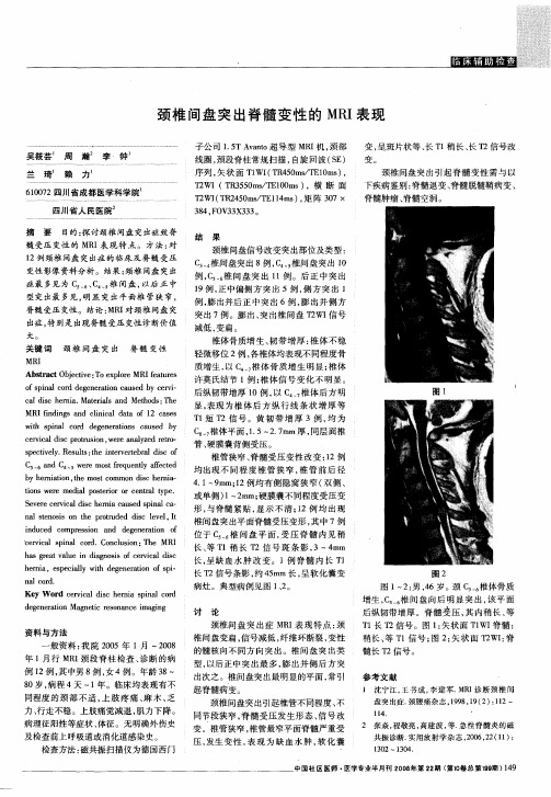 颈椎间盘突出脊髓变性的MRI表现