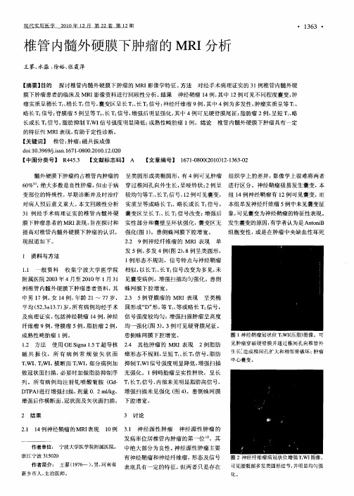 椎管内髓外硬膜下肿瘤的MRI分析