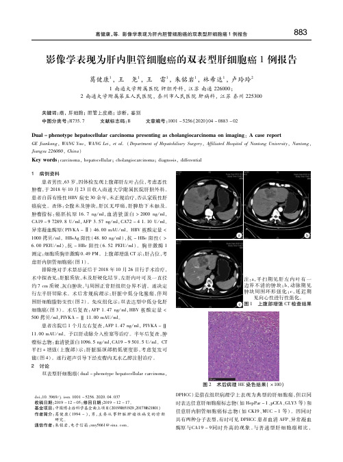影像学表现为肝内胆管细胞癌的双表型肝细胞癌1例报告 葛健康