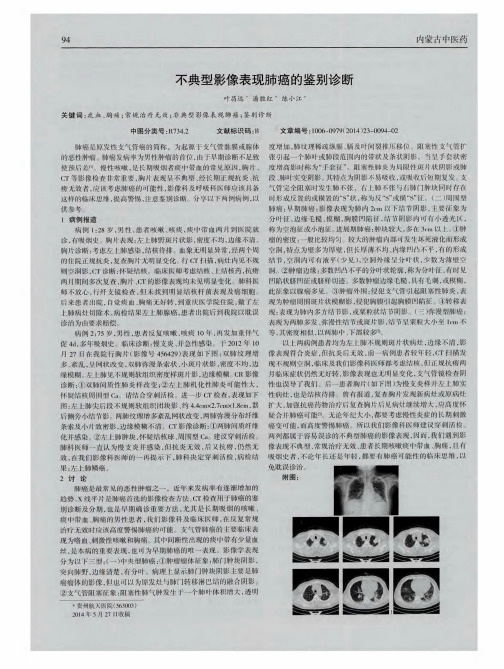 不典型影像表现肺癌的鉴别诊断