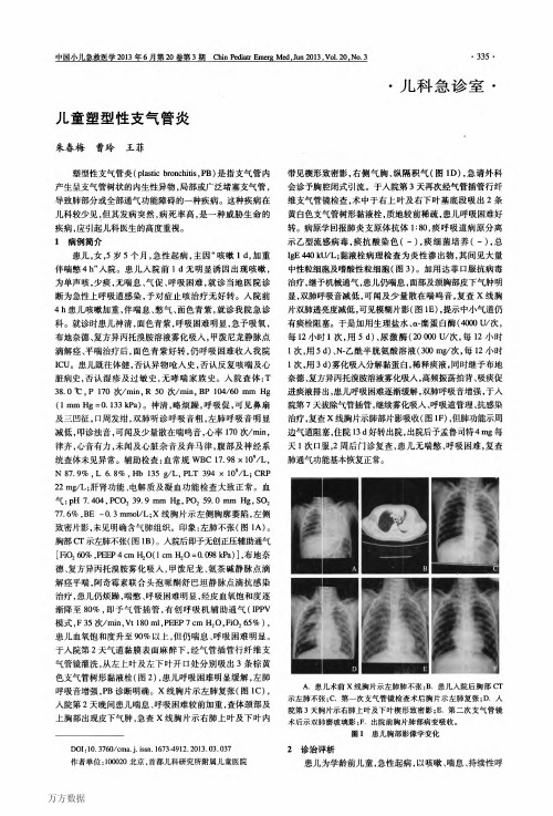 儿童塑型性支气管炎