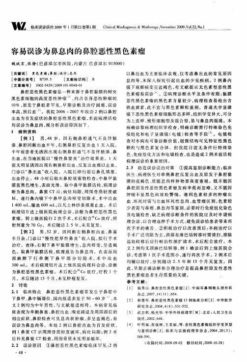 容易误诊为鼻息肉的鼻腔恶性黑色素瘤