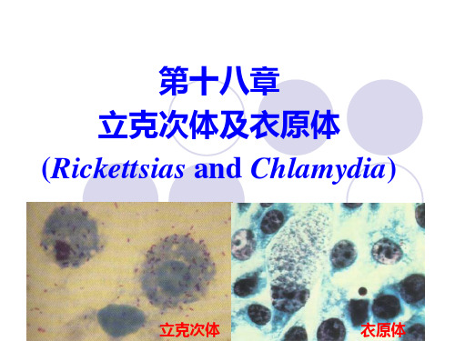 兽医微生物学课件- 立克次氏体与衣原体