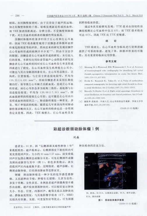 彩超诊断颈动脉体瘤1例