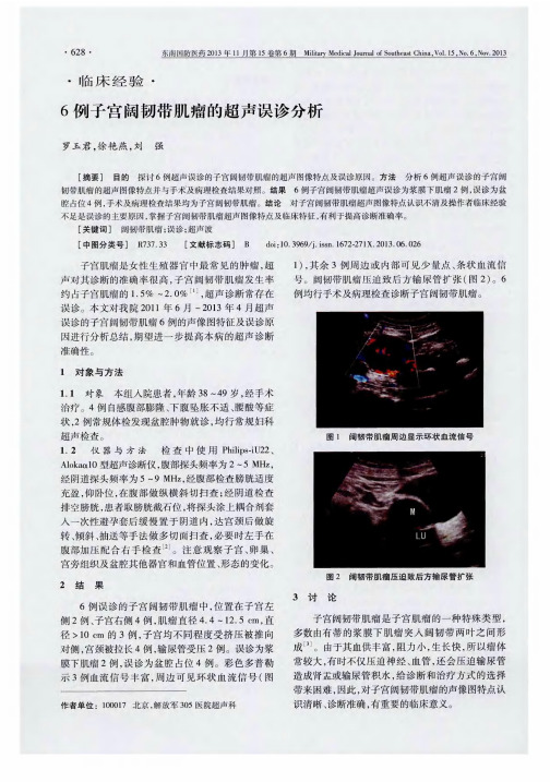 6例子宫阔韧带肌瘤的超声误诊分析