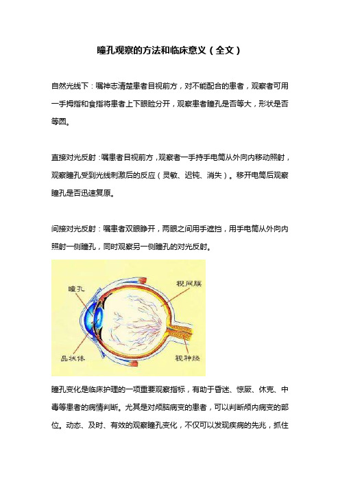 瞳孔观察的方法和临床意义(全文)