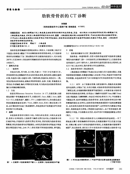 肋软骨骨折的CT诊断