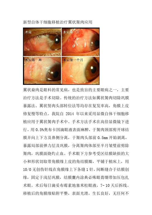 翼状胬肉