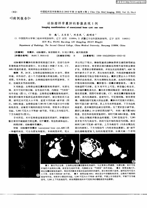 动脉瘤样骨囊肿的影像表现1例