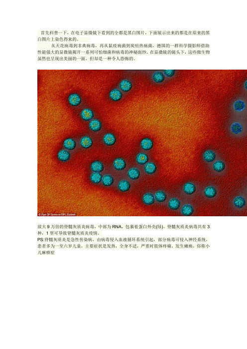 致命的美丽：显微镜下的细菌和病毒(14P)