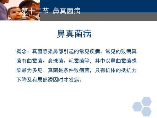 耳鼻喉科常见疾病-真菌性鼻窦炎