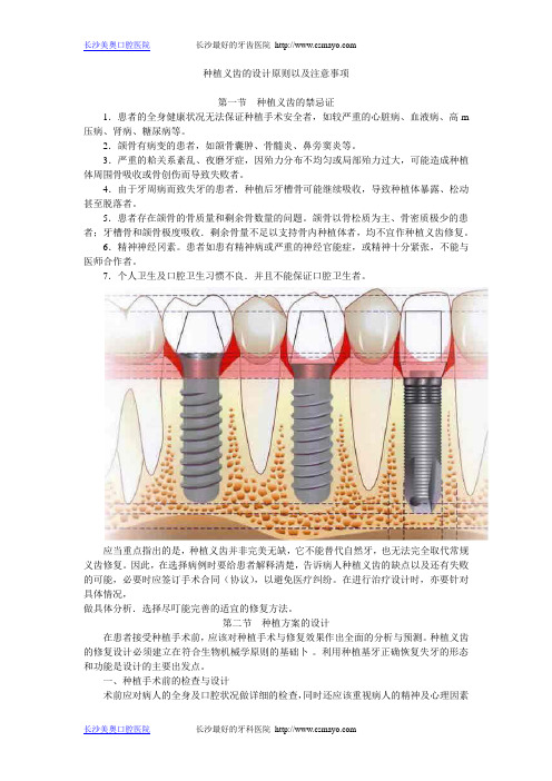 种植义齿的设计原则以及注意事项