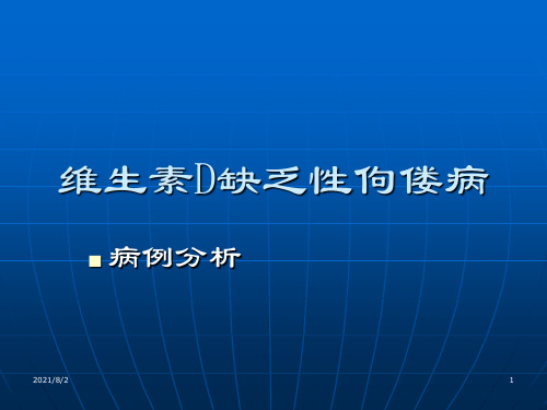 佝偻病病案分析【16页】