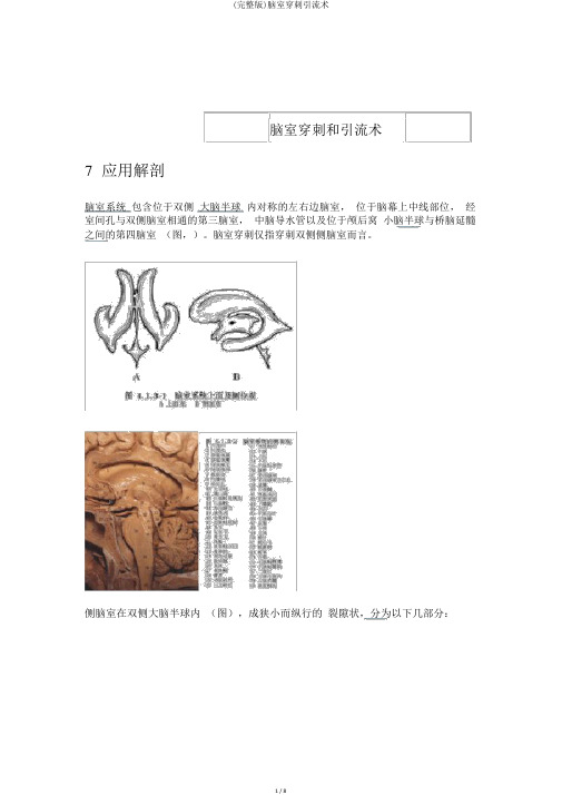 (完整版)脑室穿刺引流术