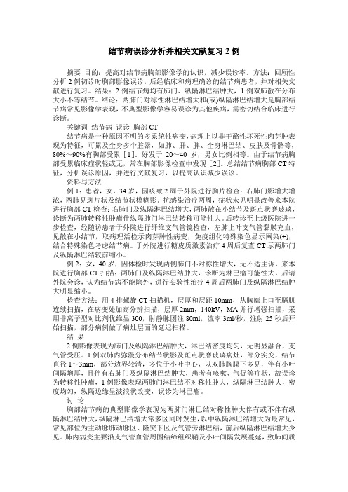 结节病误诊分析并相关文献复习2例