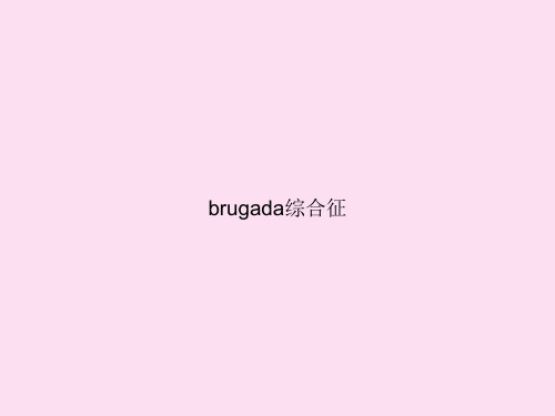 brugada综合征