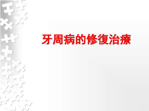 口腔修复学课件：牙周病的修复治疗