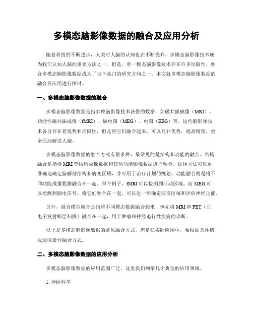 多模态脑影像数据的融合及应用分析