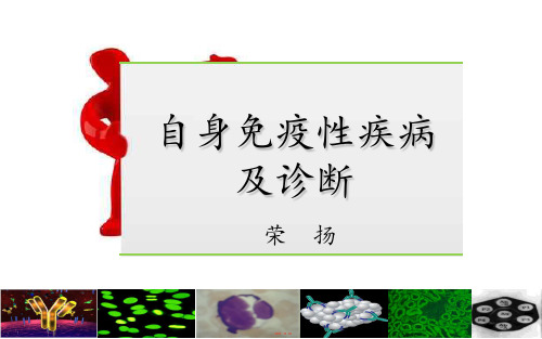 自身免疫性疾病及诊断  ppt课件