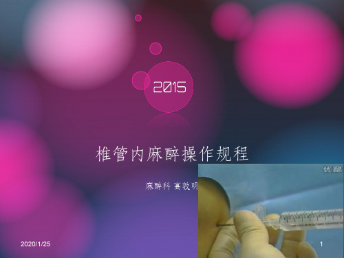 椎管内麻醉操作规程