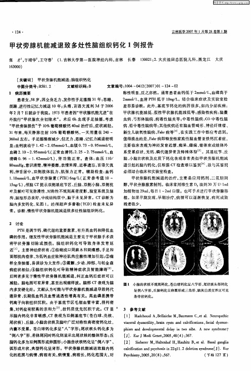 甲状旁腺机能减退致多灶性脑组织钙化1例报告