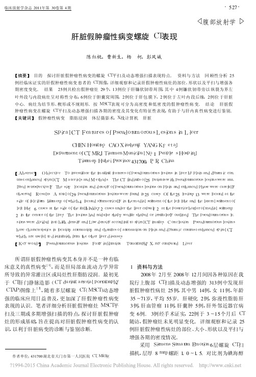 肝脏假肿瘤性病变螺旋CT表现