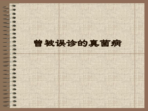 曾被误诊的真菌病