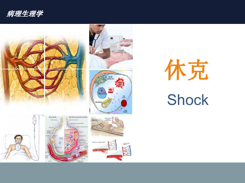 病理生理学——休克
