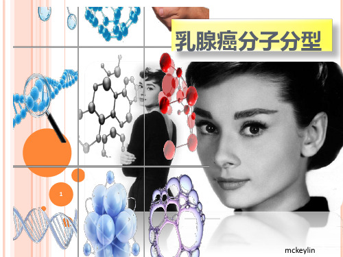 乳腺癌分子分型