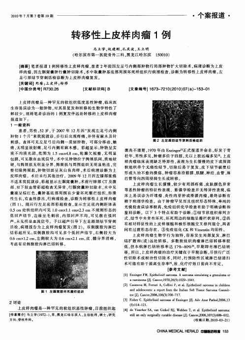 转移性上皮样肉瘤1例