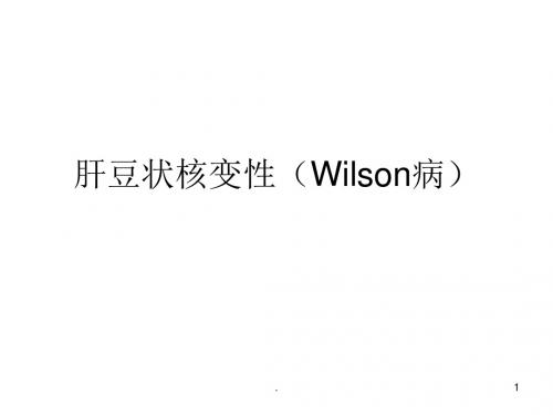 肝豆状核变性(Wilson病)