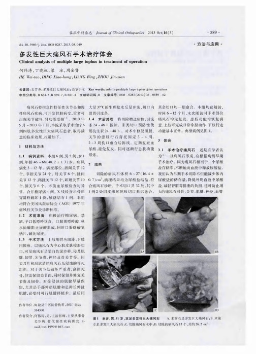 多发性巨大痛风石手术治疗体会
