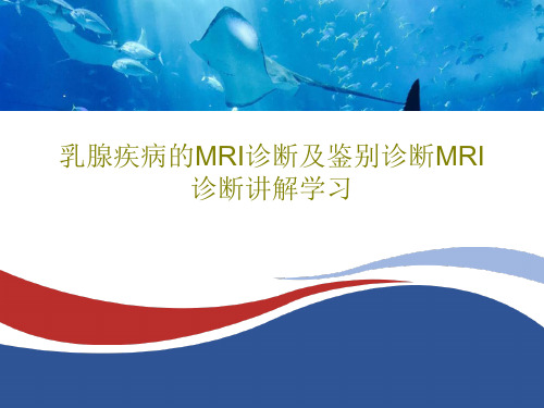 乳腺疾病的MRI诊断及鉴别诊断MRI诊断讲解学习137页PPT