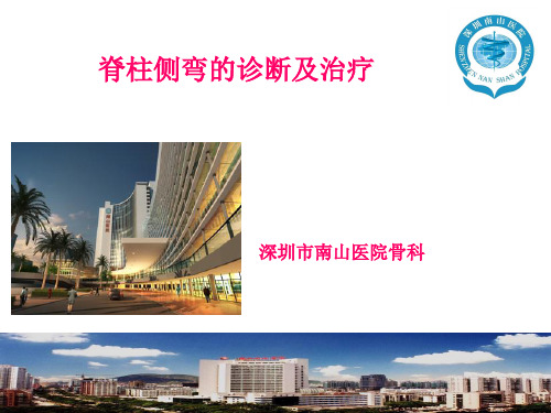 脊柱侧弯的诊断及治疗