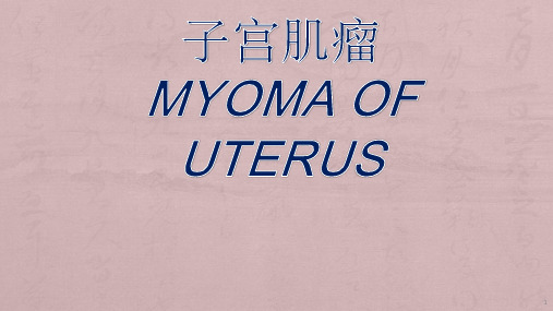 子宫肌瘤教学查房