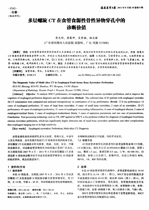 多层螺旋CT在食管食源性骨性异物穿孔中的诊断价值