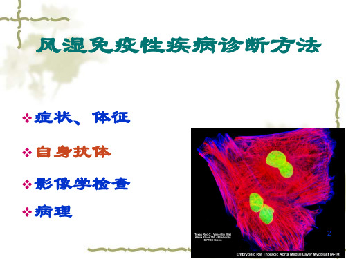 抗核抗体检测及临床意义精品PPT课件