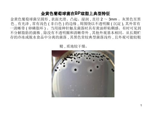 各菌菌落形态ppt课件