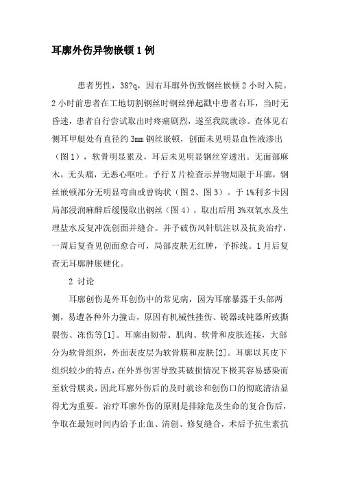 耳廓外伤异物嵌顿1例-2019年文档