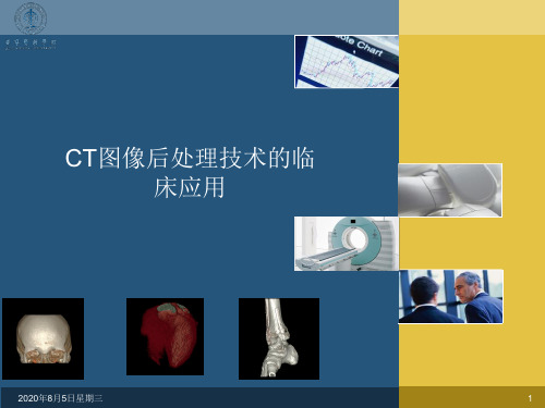 第三章多层螺旋CT后处理技术