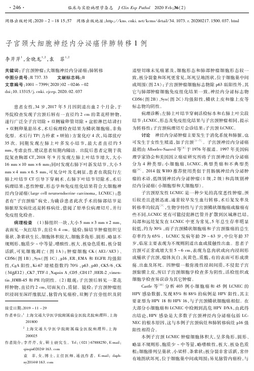 子宫颈大细胞神经内分泌癌伴肺转移1例
