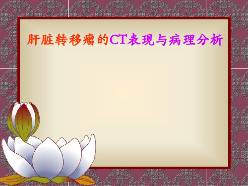 肝脏转移瘤的表现与病理ppt课件