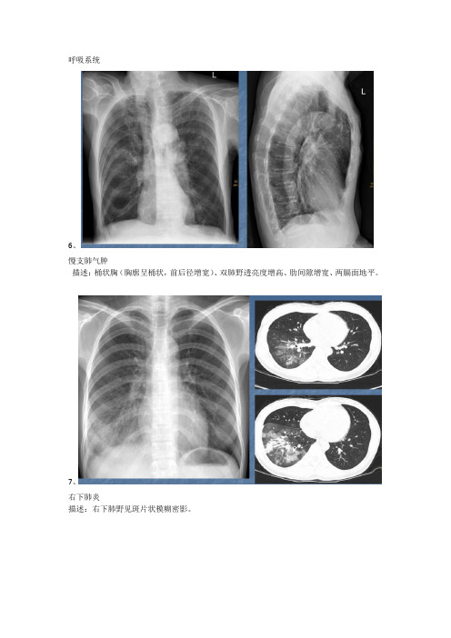 呼吸系统影像学