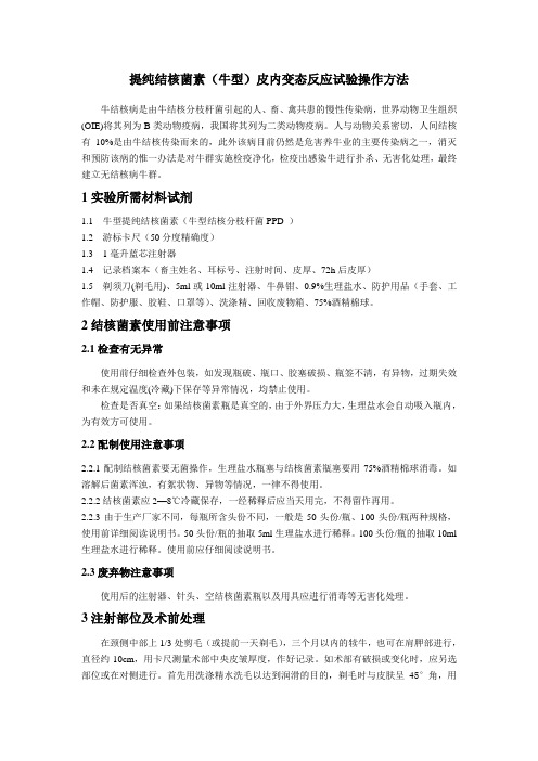 提纯结核菌素